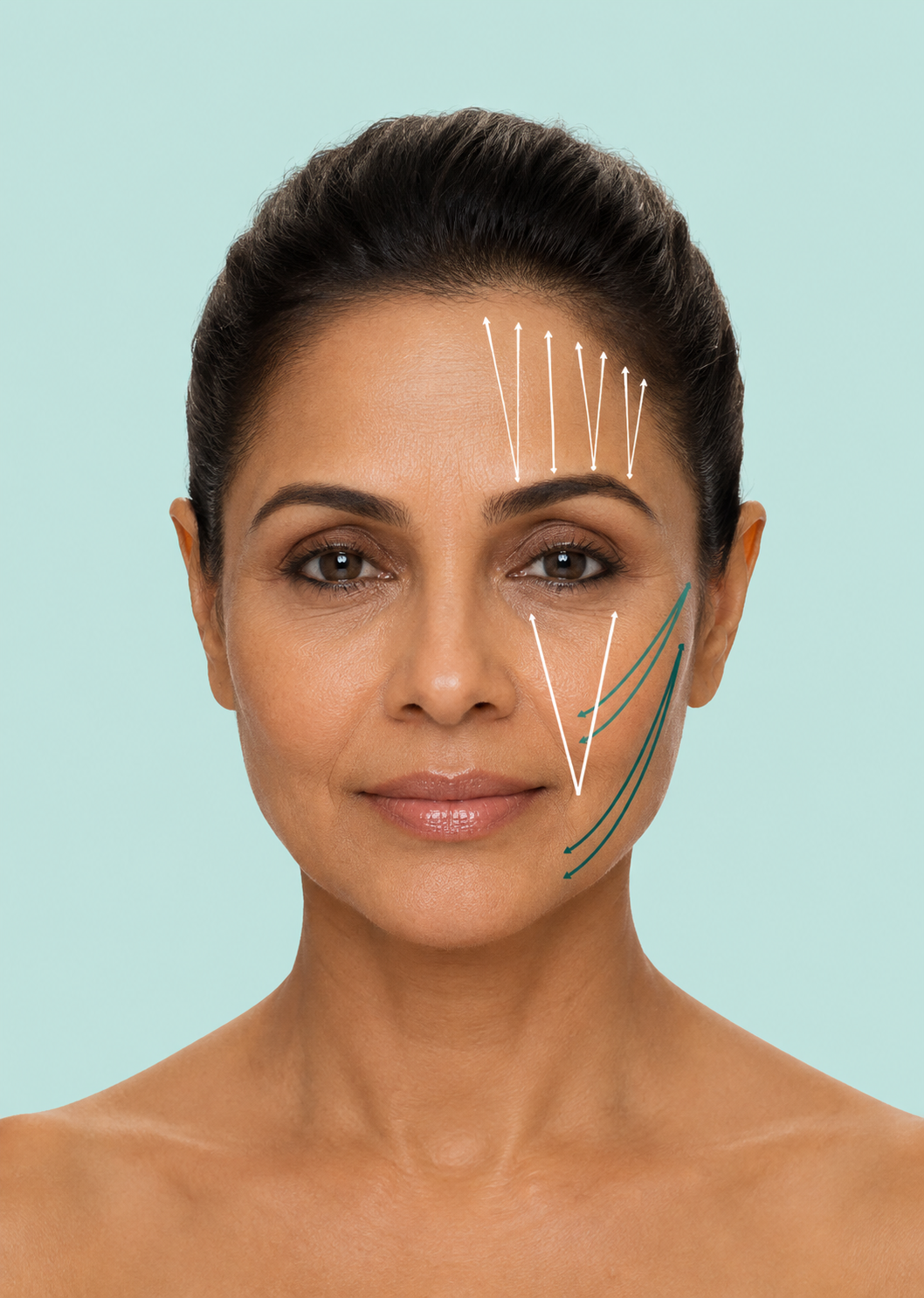 Thread Lift (Aphrodite)